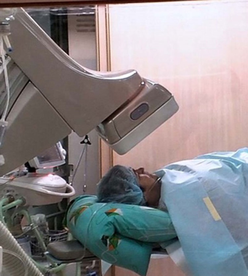 Ангіографія/коронарографія