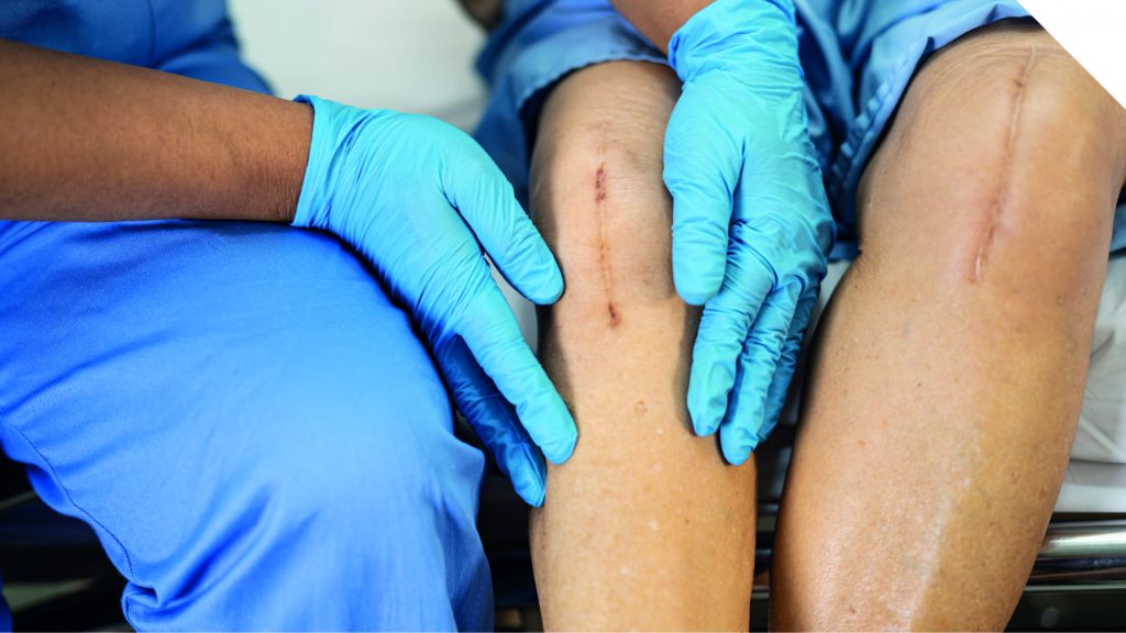 Пластика зв'язок та сухожилля